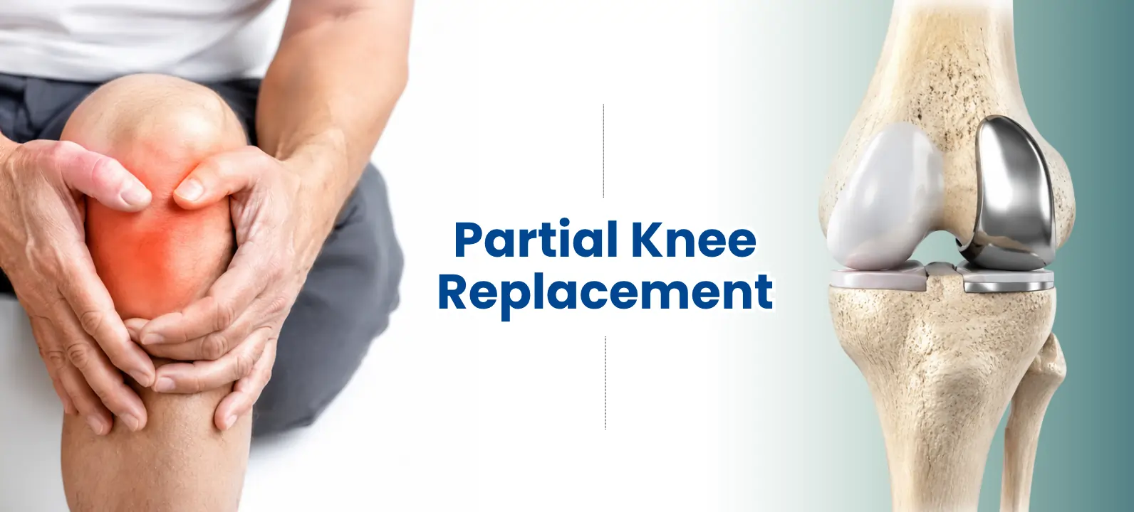 Race Knee Clinic